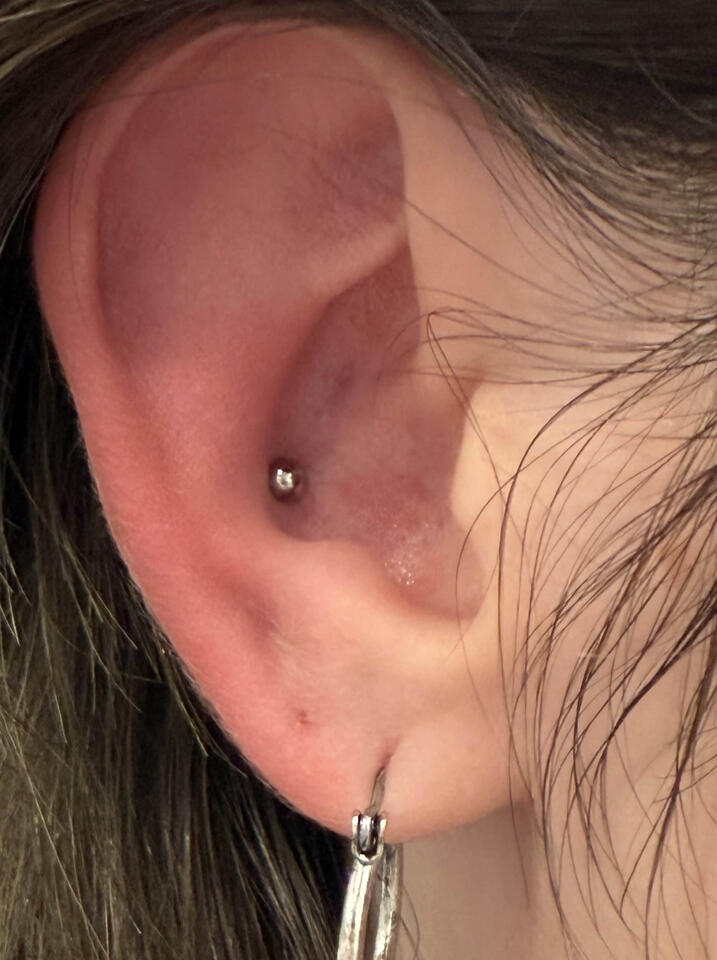 this is a half dome, not a bead!